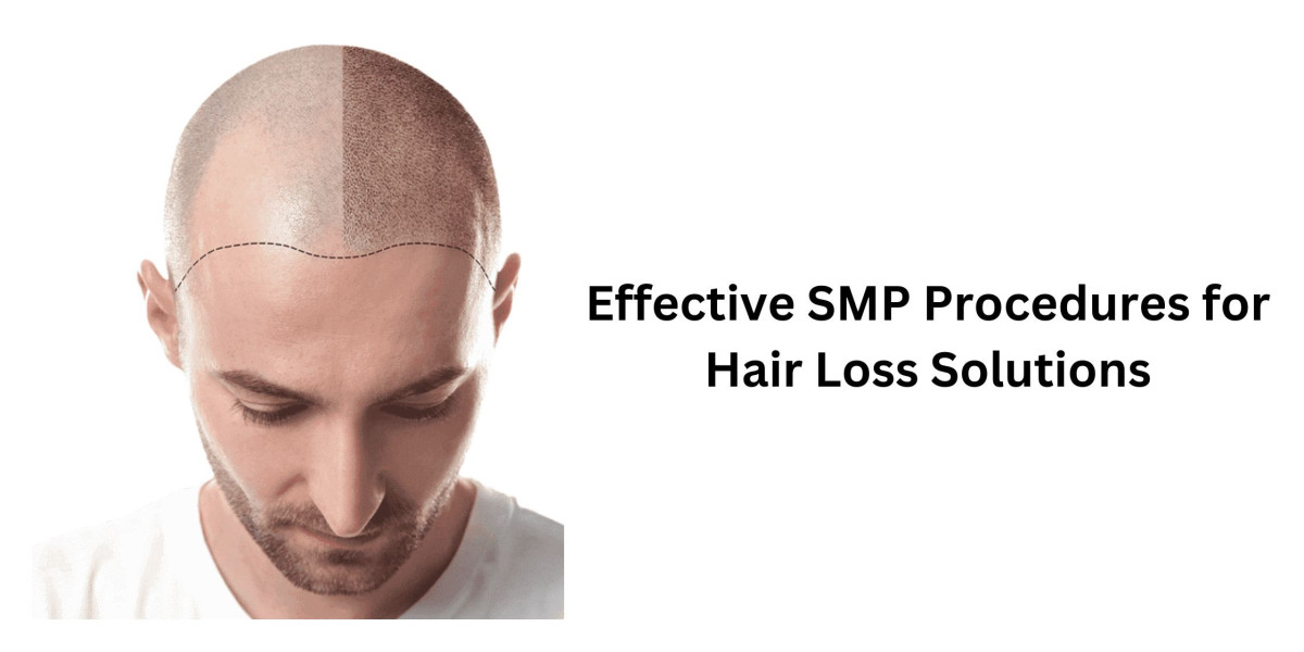 Effective SMP Procedures for Hair Loss Solutions