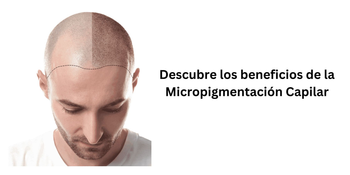 Micropigmentación Capilar: La Guía Definitiva